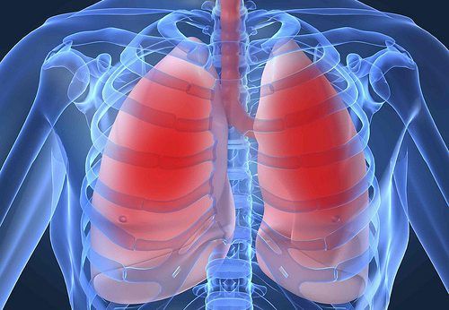 bronchitis pneumonia e1486603681993