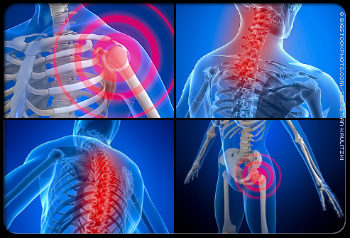 fibromyalgia s7